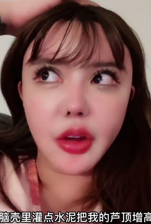 韩安冉整形医生爆料视频,揭秘网红整形背后的真相 第2张 韩安冉整形医生爆料视频,揭秘网红整形背后的真相 第2张